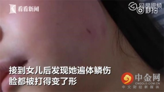 關(guān)注校園暴力：初二女生被同學(xué)暴打拍裸照，父母報警三次